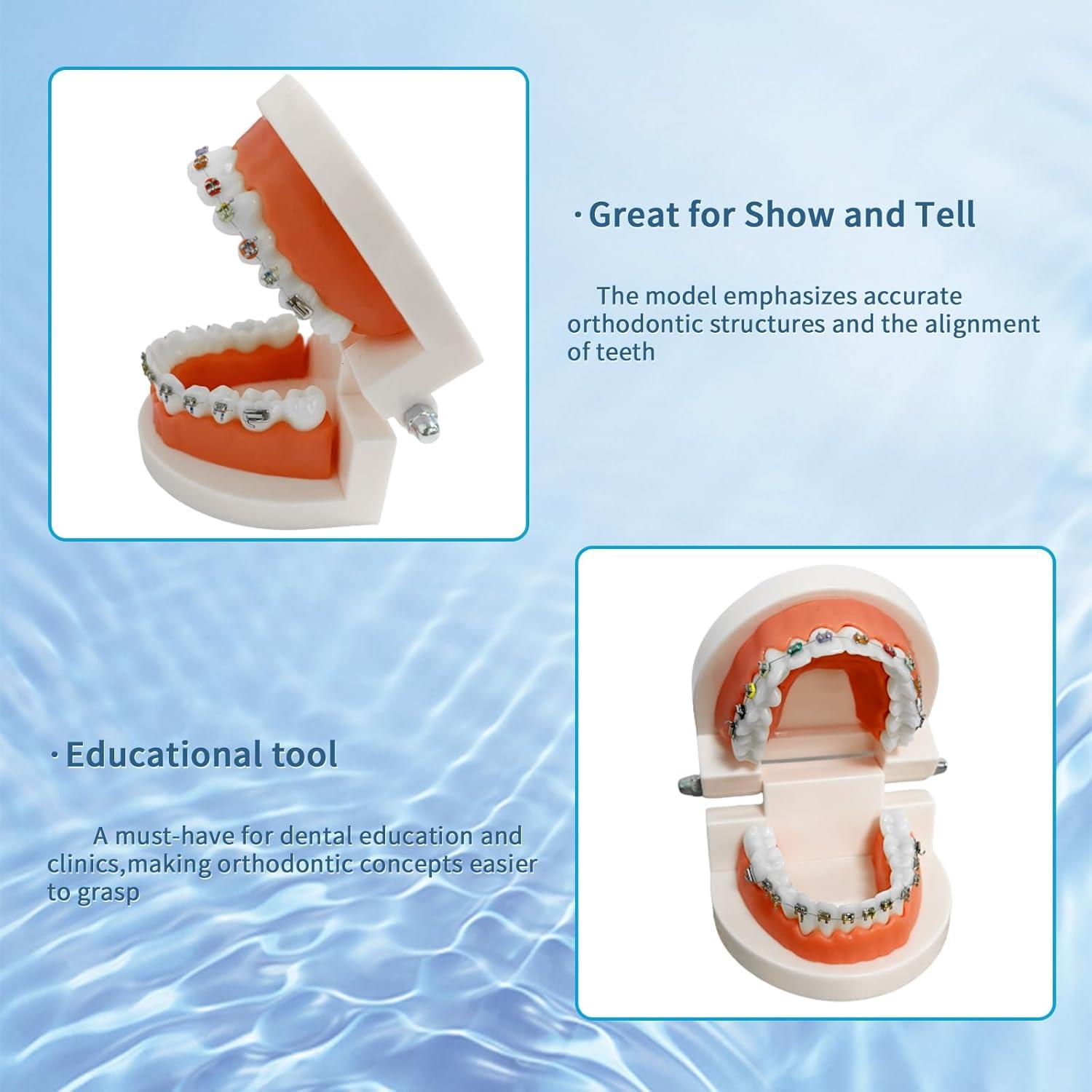 Modelo Dental Ortodontico Ceonam JY+YT con Brackets Coloridos