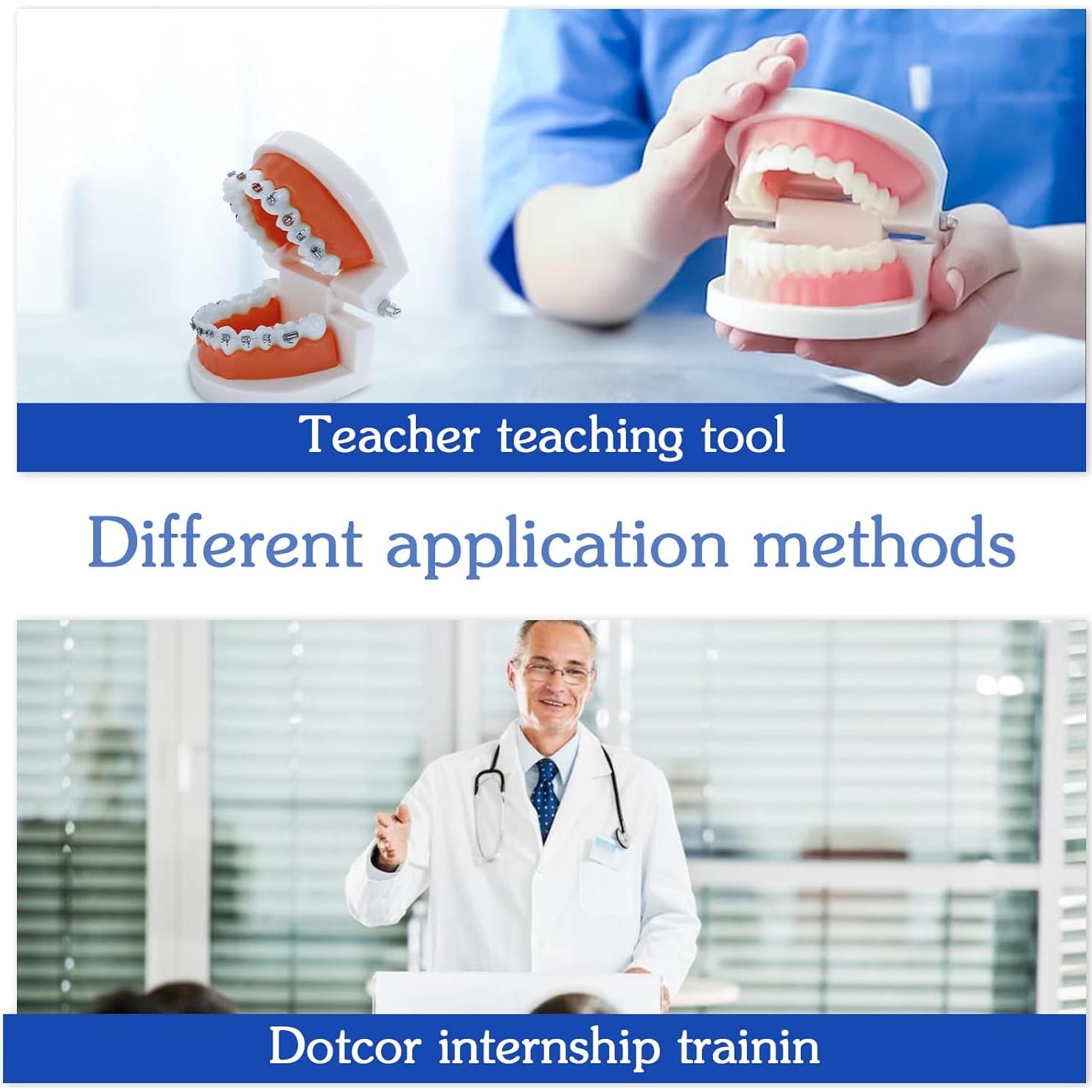 Modelo Dental Ortodontico Ceonam JY+YT con Brackets Coloridos