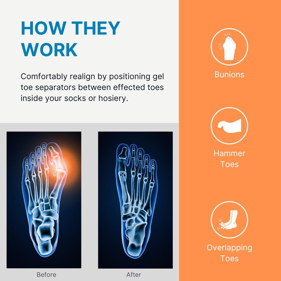 Separadores de Dedos NatraCure - Paquete de 12 Unisex