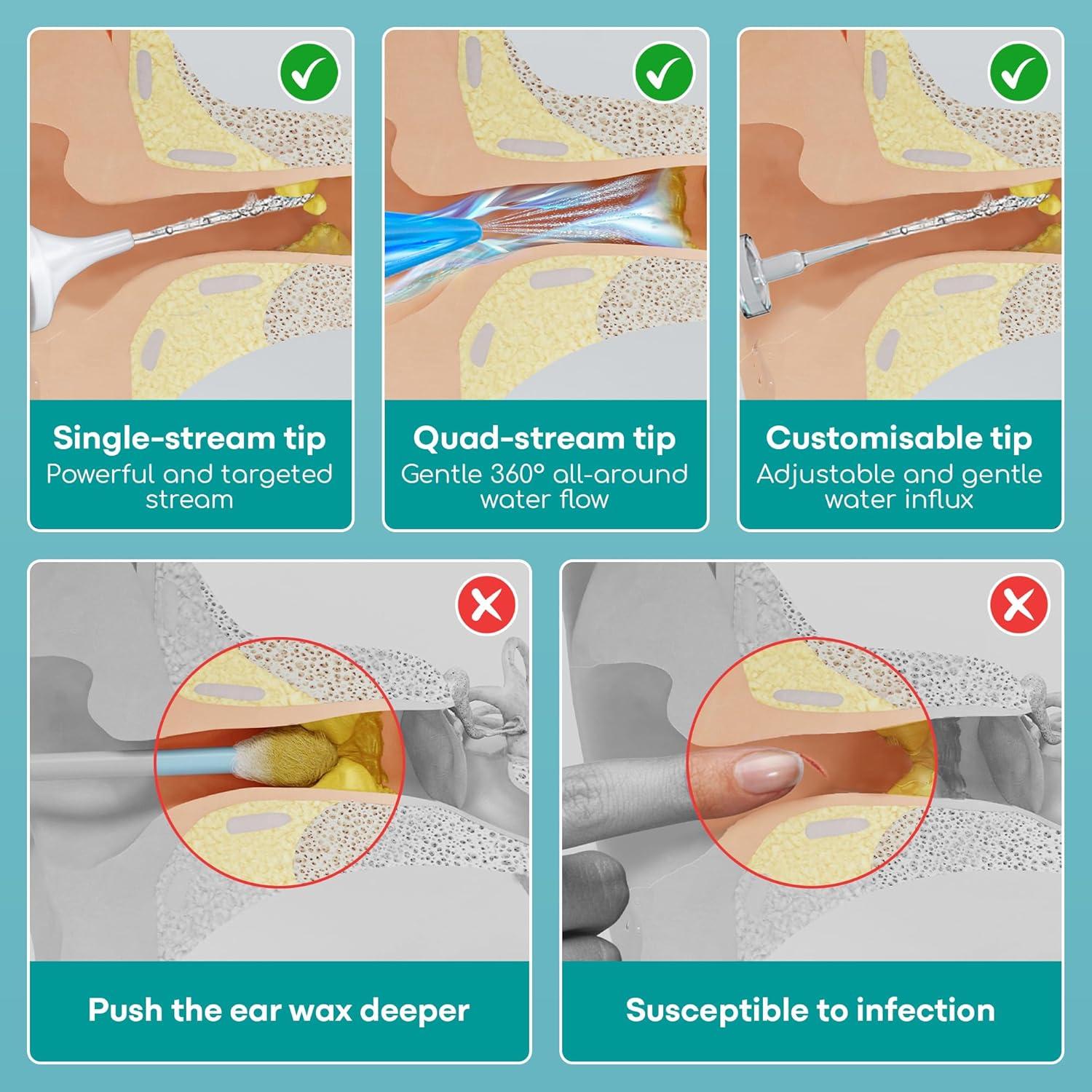 Kit de Limpieza de Oídos Medi Grade con Botella y Jeringa