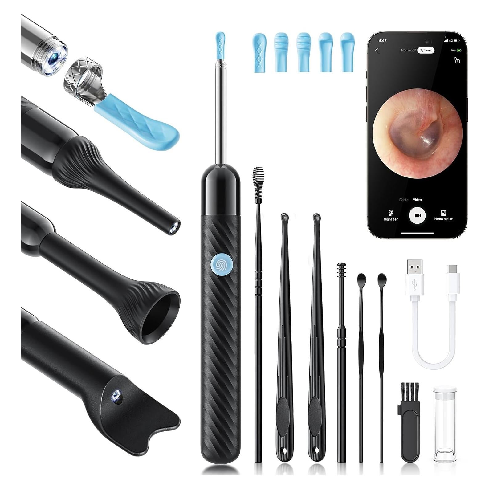Limpiador de Oídos Loyker X6 con Cámara 1080P y Luz LED