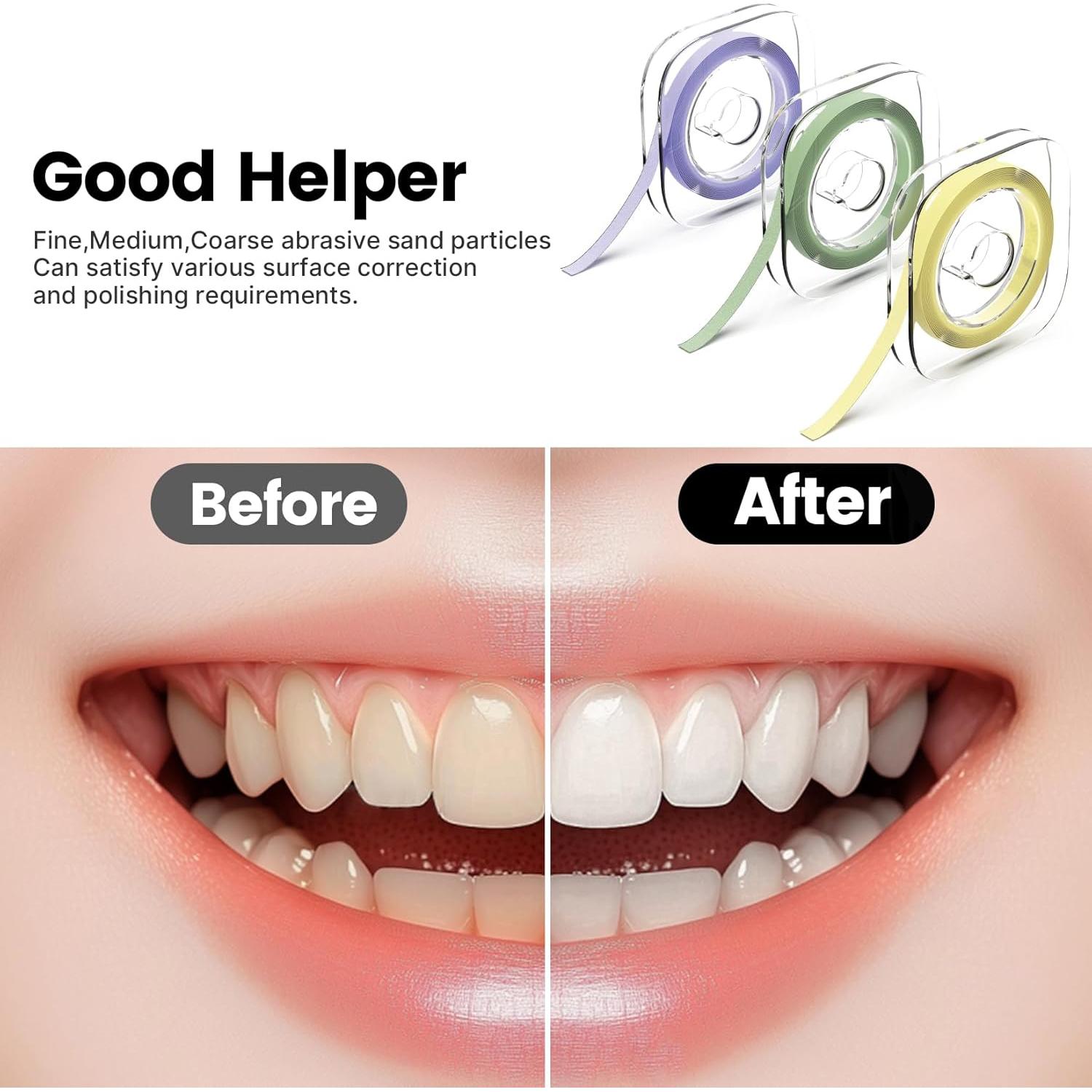 Juego de Tiras de Pulido Dental RAZOKO 3 Variantes 6m