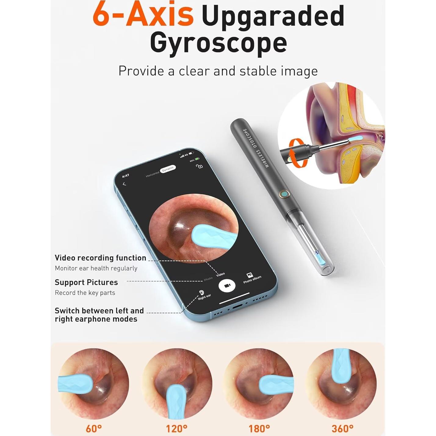 Limpiador de Oídos DEETOK con Cámara HD 1080P y 50 Puntas