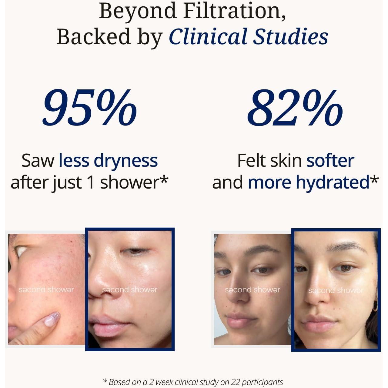 Cabezal de Ducha Filtrado Second Shower Rosa Flor con Vitamina C