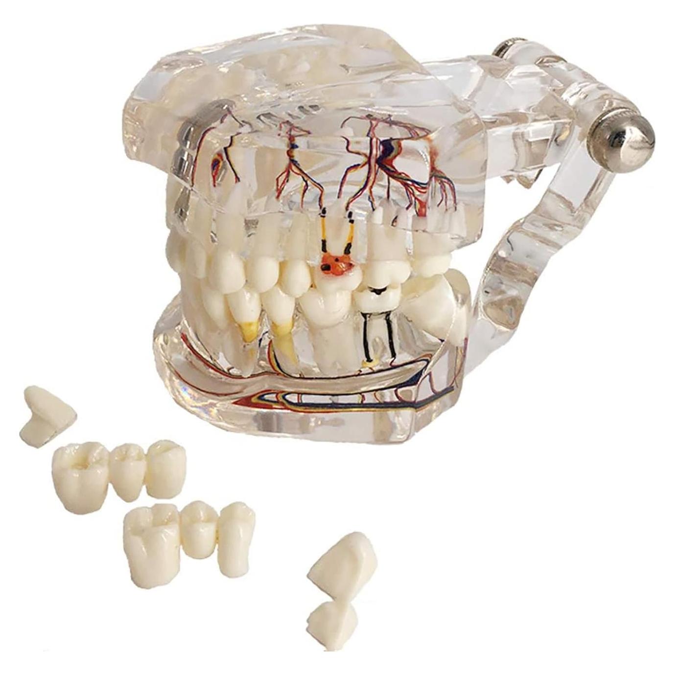 Modelo Dental Acrílico YOUYA para Enseñanza 9.4x6.6 cm