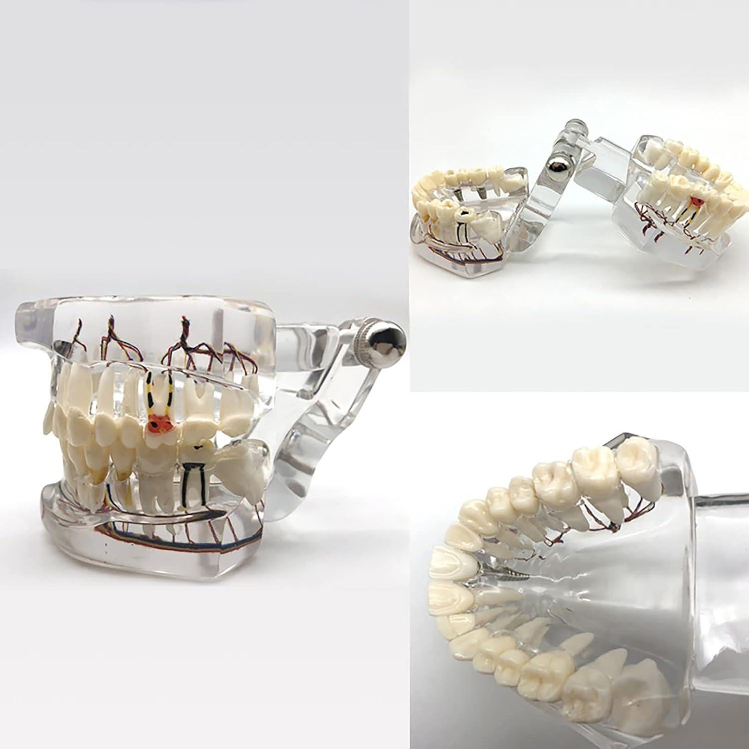 Modelo Dental Acrílico YOUYA para Enseñanza 9.4x6.6 cm