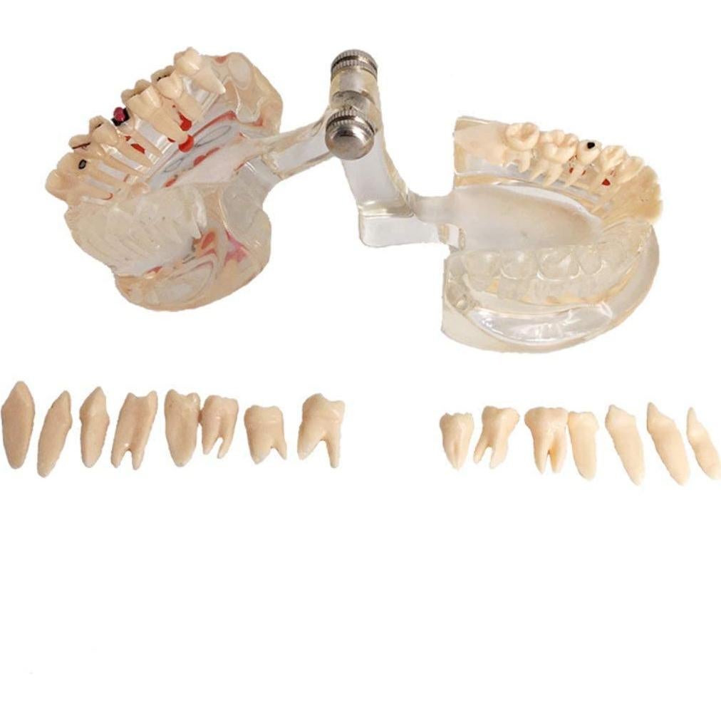 Modelo Dental Acrílico YOUYA para Enseñanza 9.4x6.6 cm