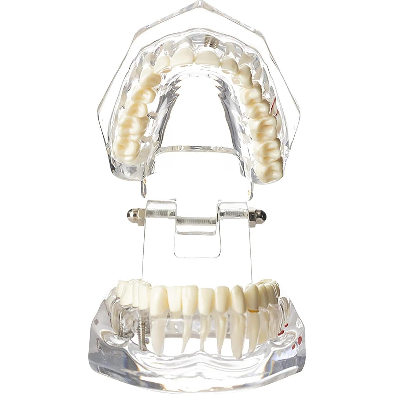 Modelo Dental Typodont Implantológico Dentalmall 2001C
