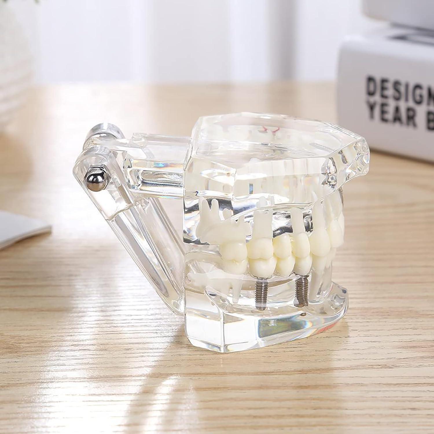 Modelo Dental Typodont Implantológico Dentalmall 2001C