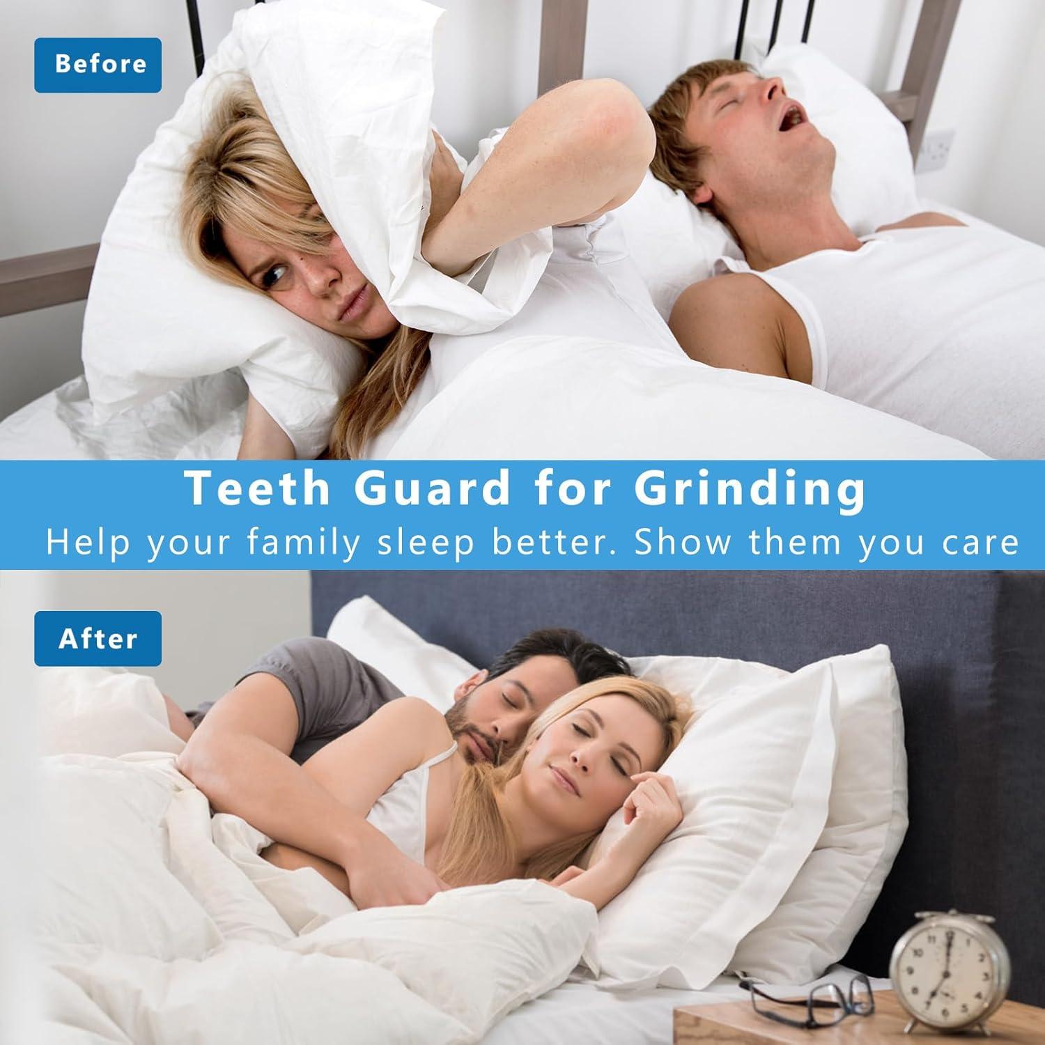 Protector Bucal Nocturno Vixino para Rechinar Dientes - 4 Piezas