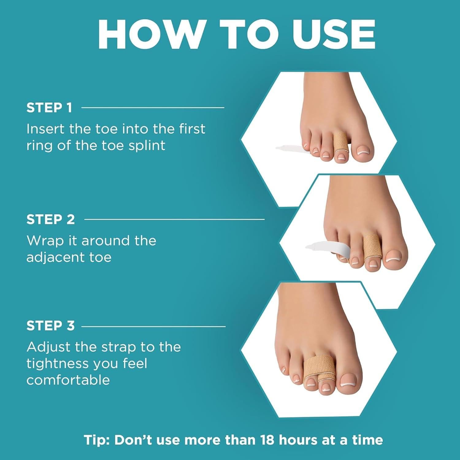 Homergy Hammer Toe corrector for Women and Men, 4 Pack, (Next Generation), FSA HSA Eligible, Reusable Fabric Buddy Wraps for Broken Toes, Hammertoe Corrector