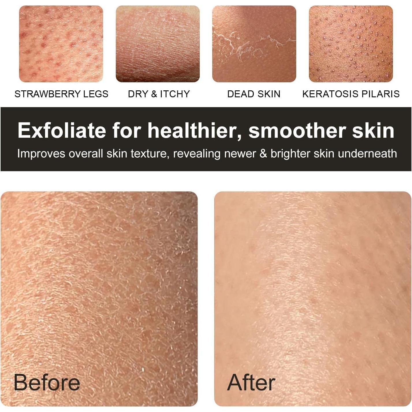 Korean Exfoliating Mitt, Deep Exfoliating Glove, 3pc Body Exfoliator Glove, Exfoliator Body Scrubber, Bath Shower Scrub Gloves, Self Tan Remover, Smooth Skin, Keratosis Pilaris Removal