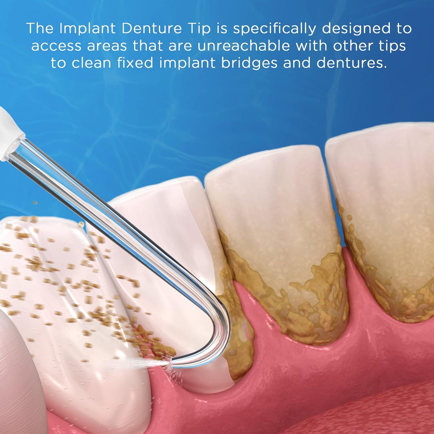Consejos Waterpik Oralphi para Dentaduras Implantadas - 6 Pzs