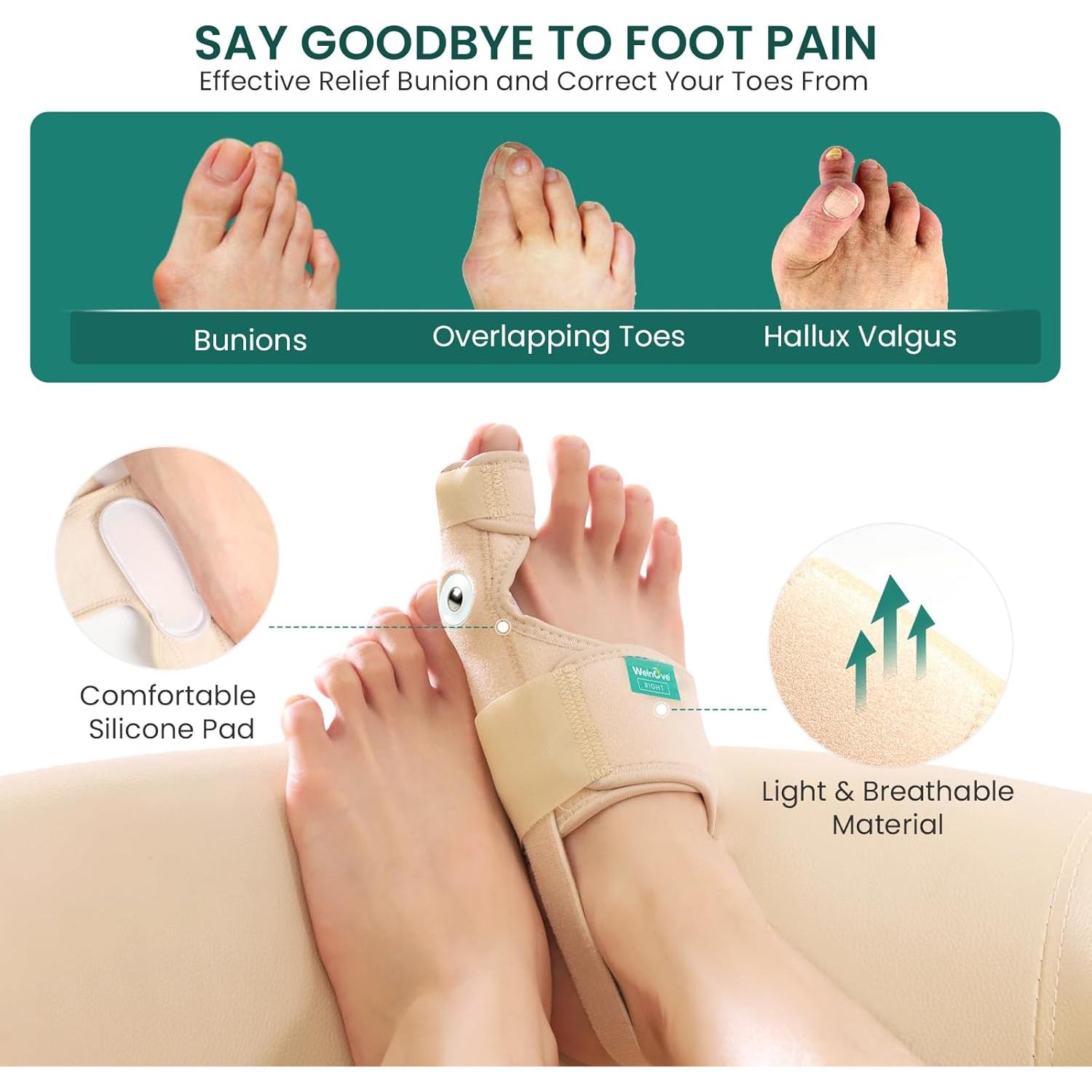 Corrector de Juanetes Welnove - Férula Ortopédica Beige - 2 Unidades