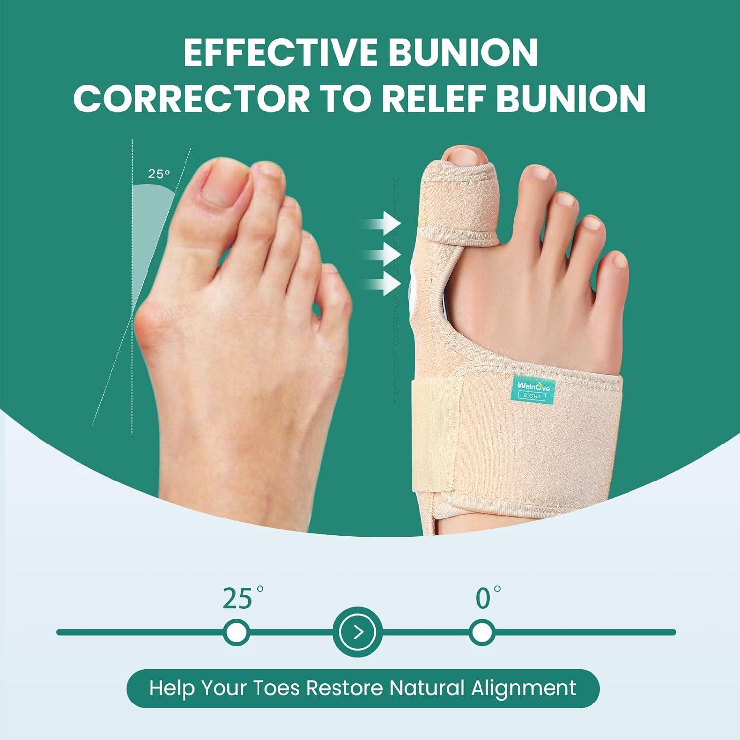 Corrector de Juanetes Welnove - Férula Ortopédica Beige - 2 Unidades