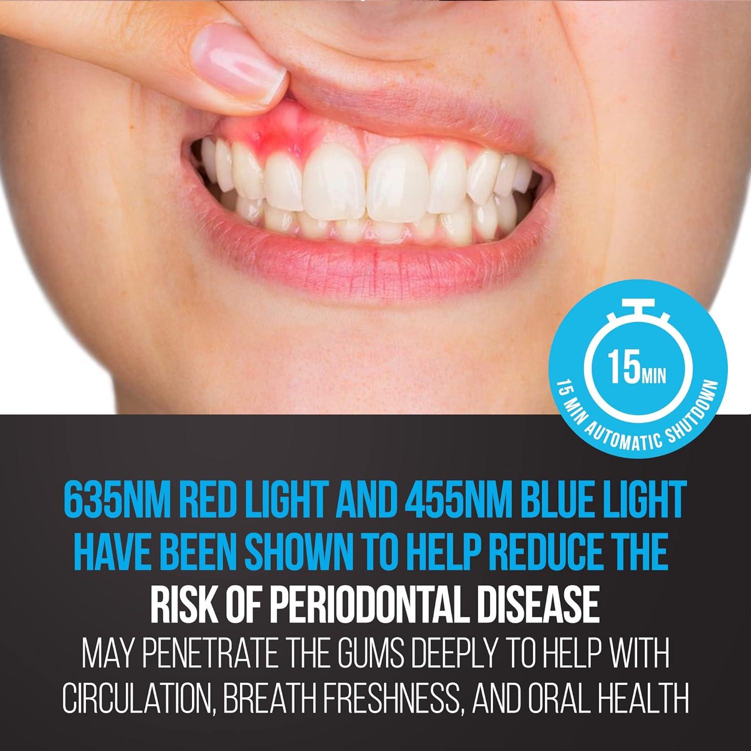 Luz LED Dental Starlite Smile 32 LEDs Rojo y Azul