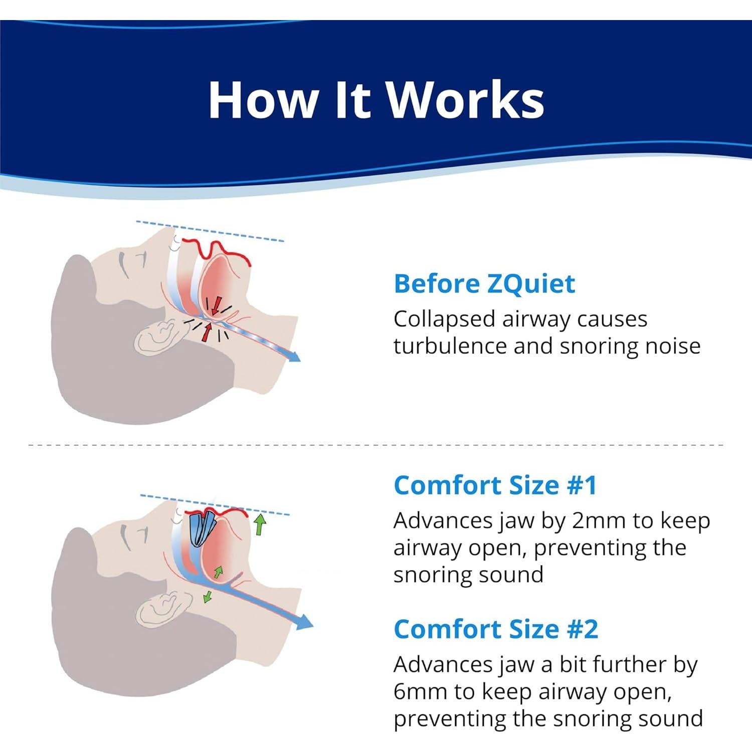 Dispositivo Bucal Antisnore ZQuiet + Limpiador 44.36ml