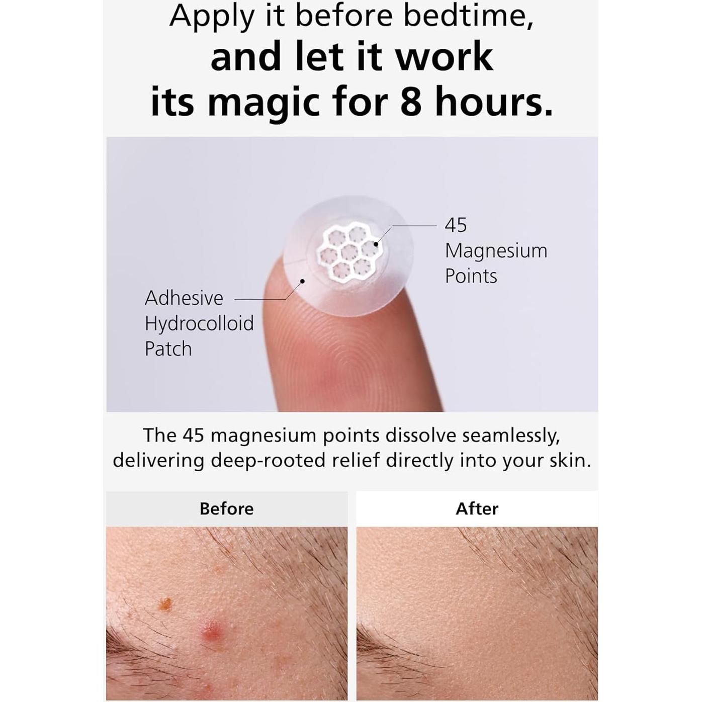 EasyDerm Parches Calmantes de Magnesio - 30 Parches Individuales