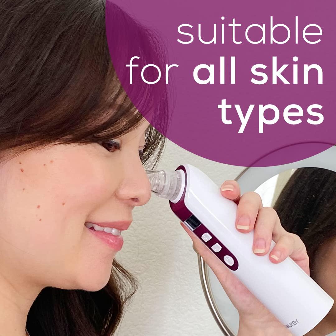 Removedor de Puntos Negros Beurer FC41 con 3 Cabezales y 5 Niveles