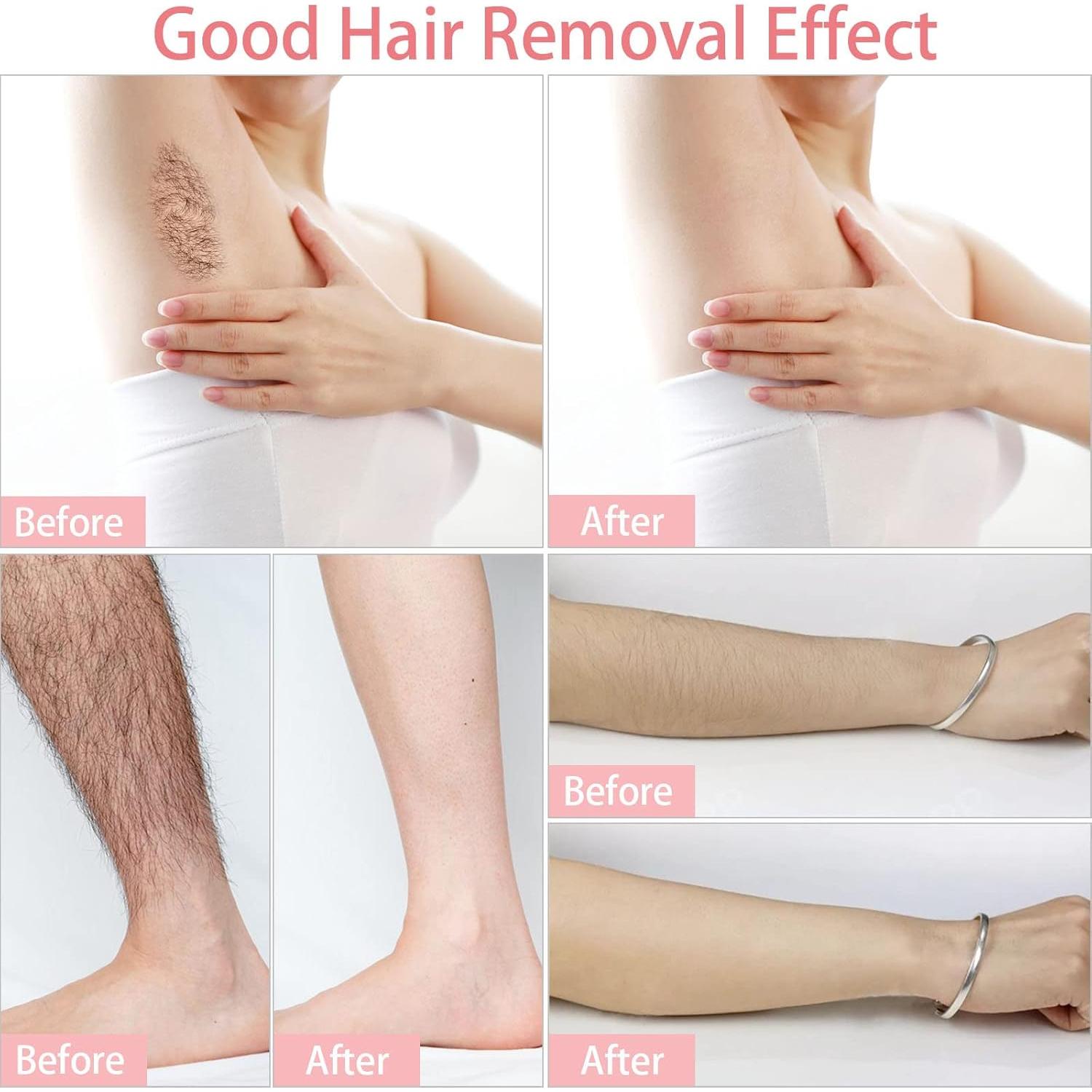 Tiras de Cera para Depilación Facial SEPGLITTER 300 Piezas 10x4 cm