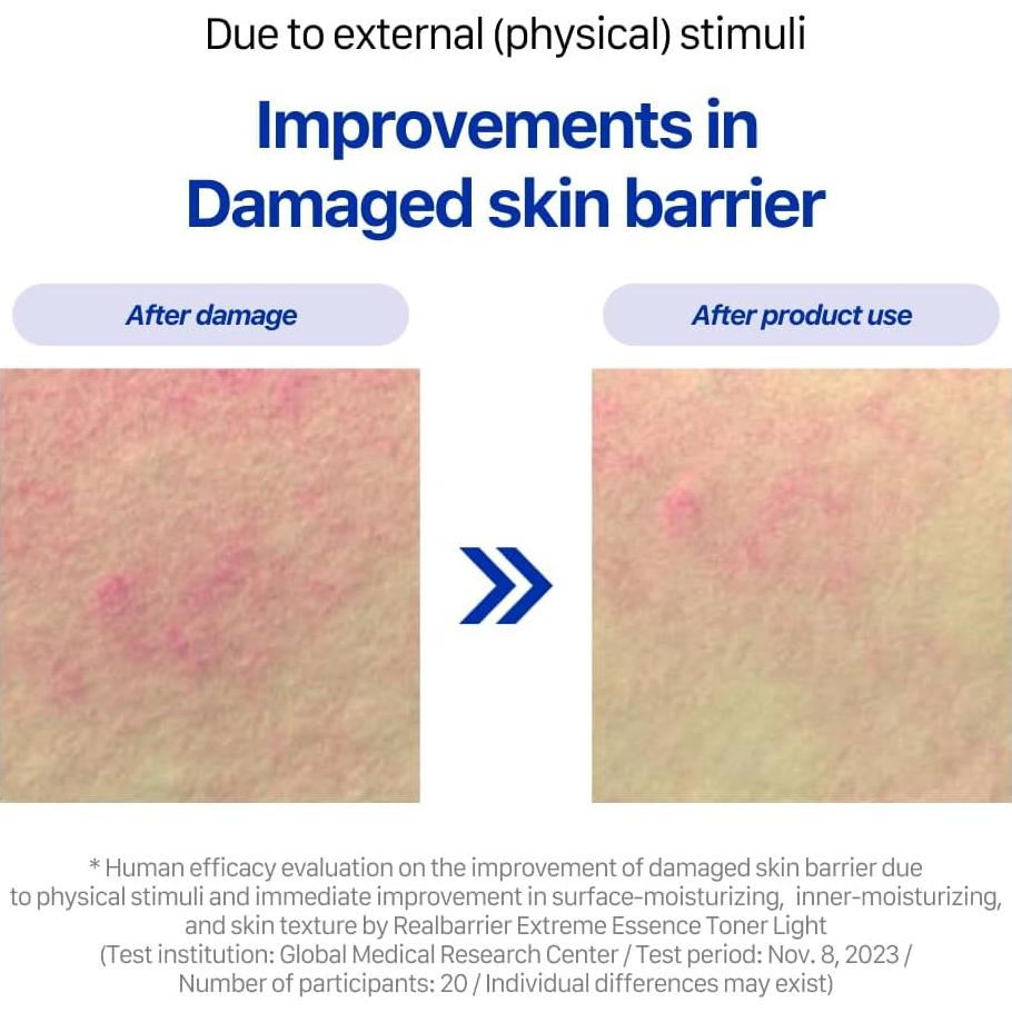Real Barrier Extreme Essence Toner Light 6.76 Fl Oz | Hyaluronic Acid Panthenol Face Moisturizer for Sensitive Dry Skin | Soothing & Hydrating Moisturizing Toner for Face | Korean Skin Care