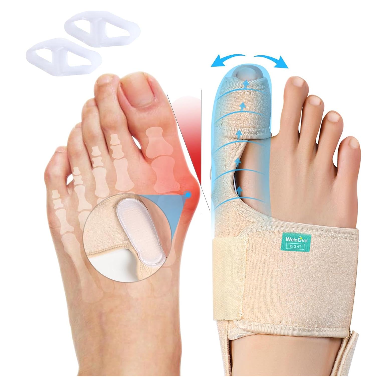 Corrector de Juanetes Welnove para Hombres y Mujeres - 1 Par Ajustable con Gel