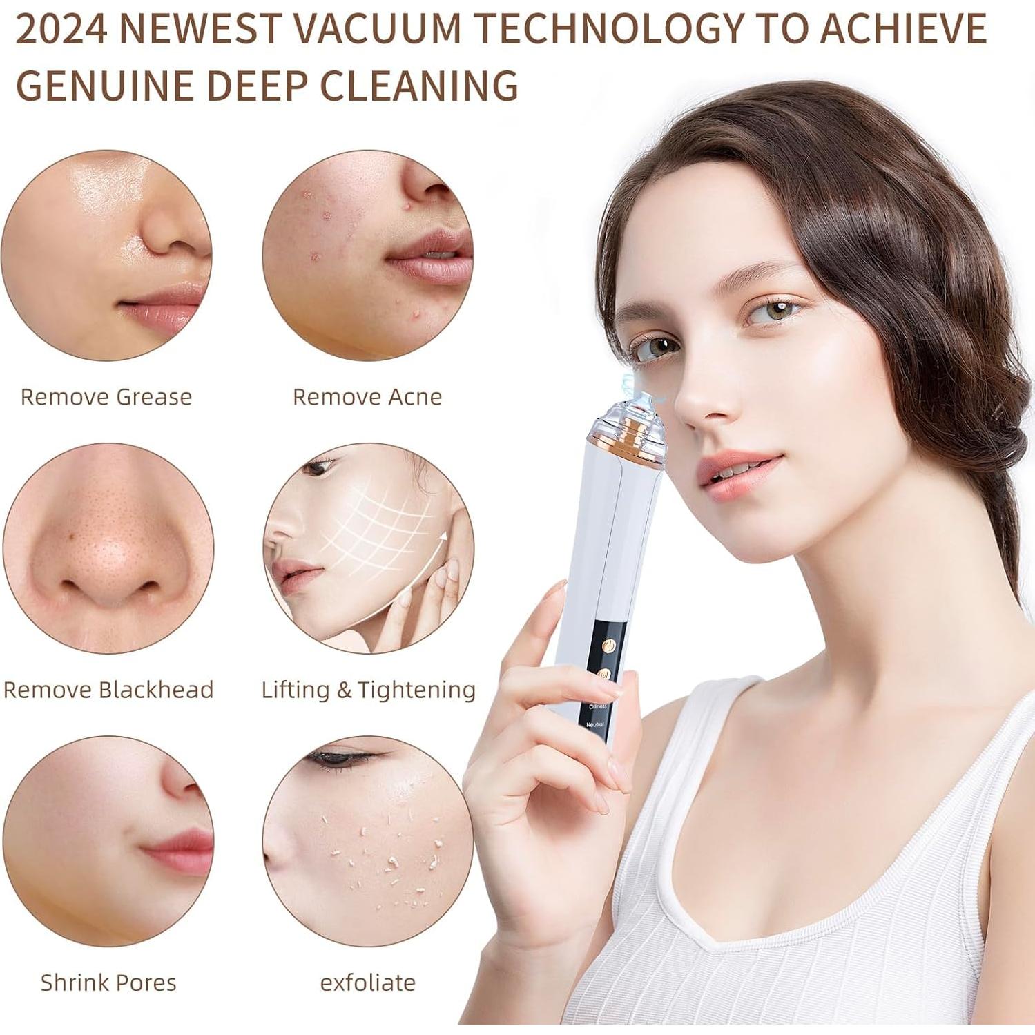 Aspiradora de Poros YUZYBH Limpiador Facial USB 3 Niveles