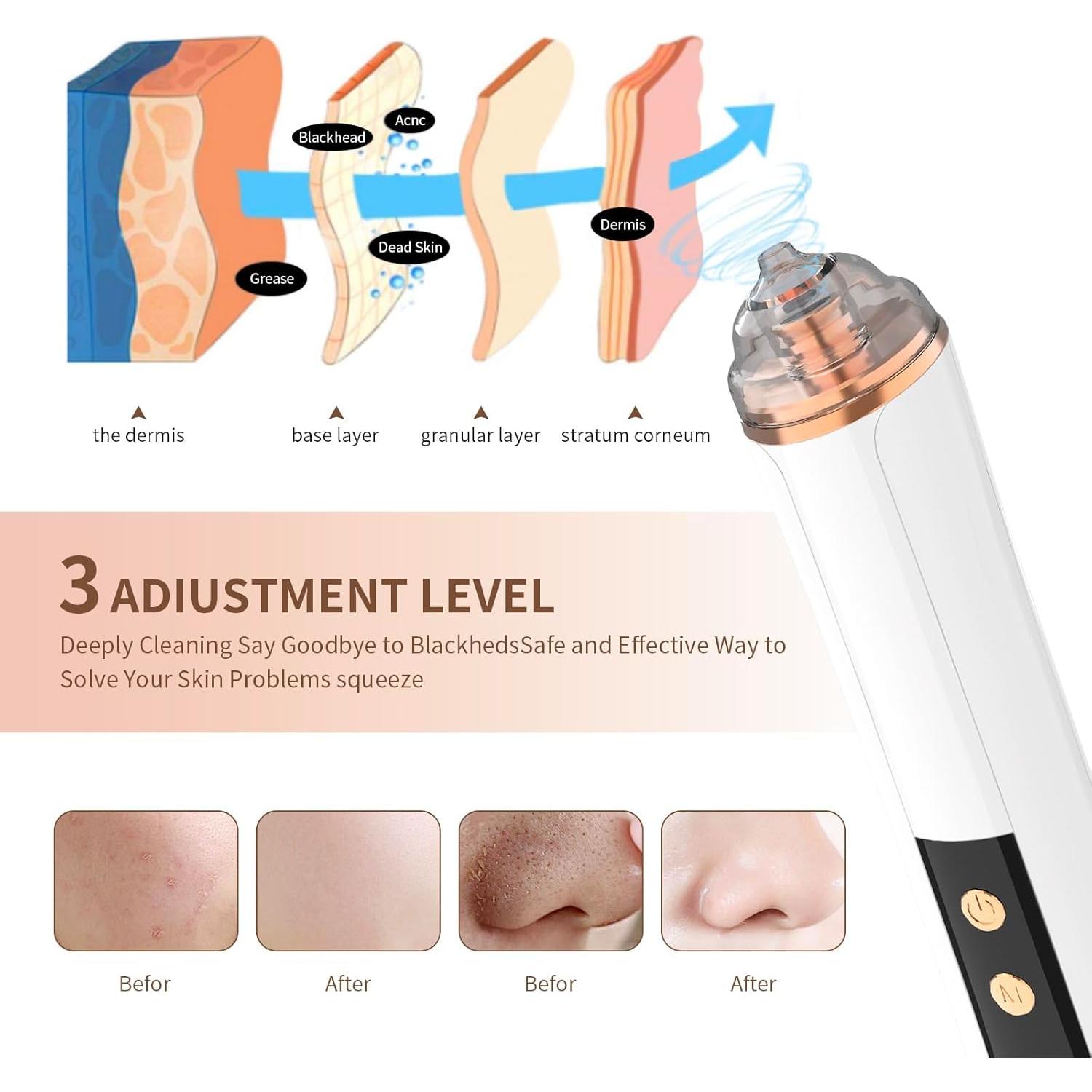 Aspiradora de Poros YUZYBH Limpiador Facial USB 3 Niveles