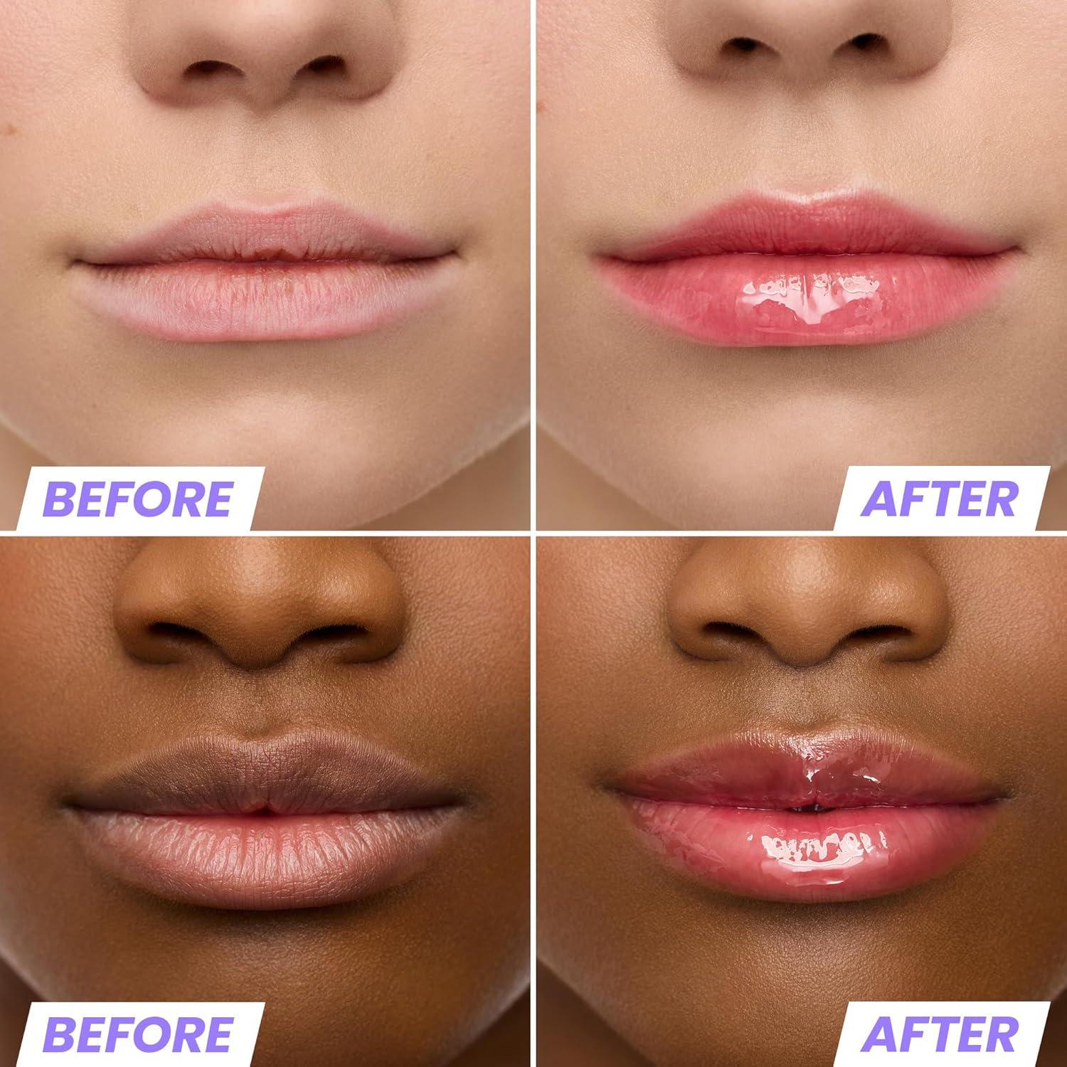 Suero Labial Hidratante Wonderskin Lip Rehab Tinte Rojo Amour