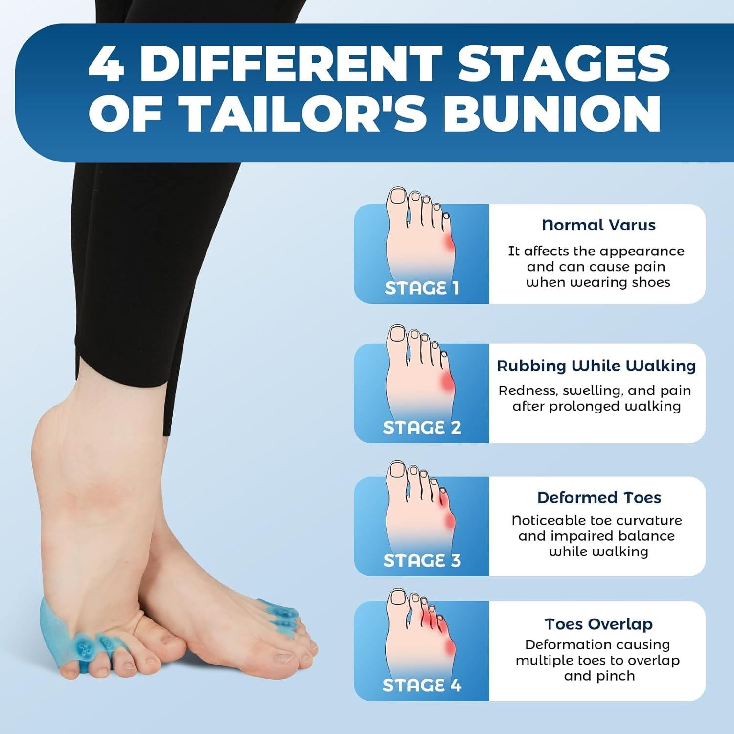 Corrector de Juanete de Sastre Tevezo - Separadores de Dedo Azul