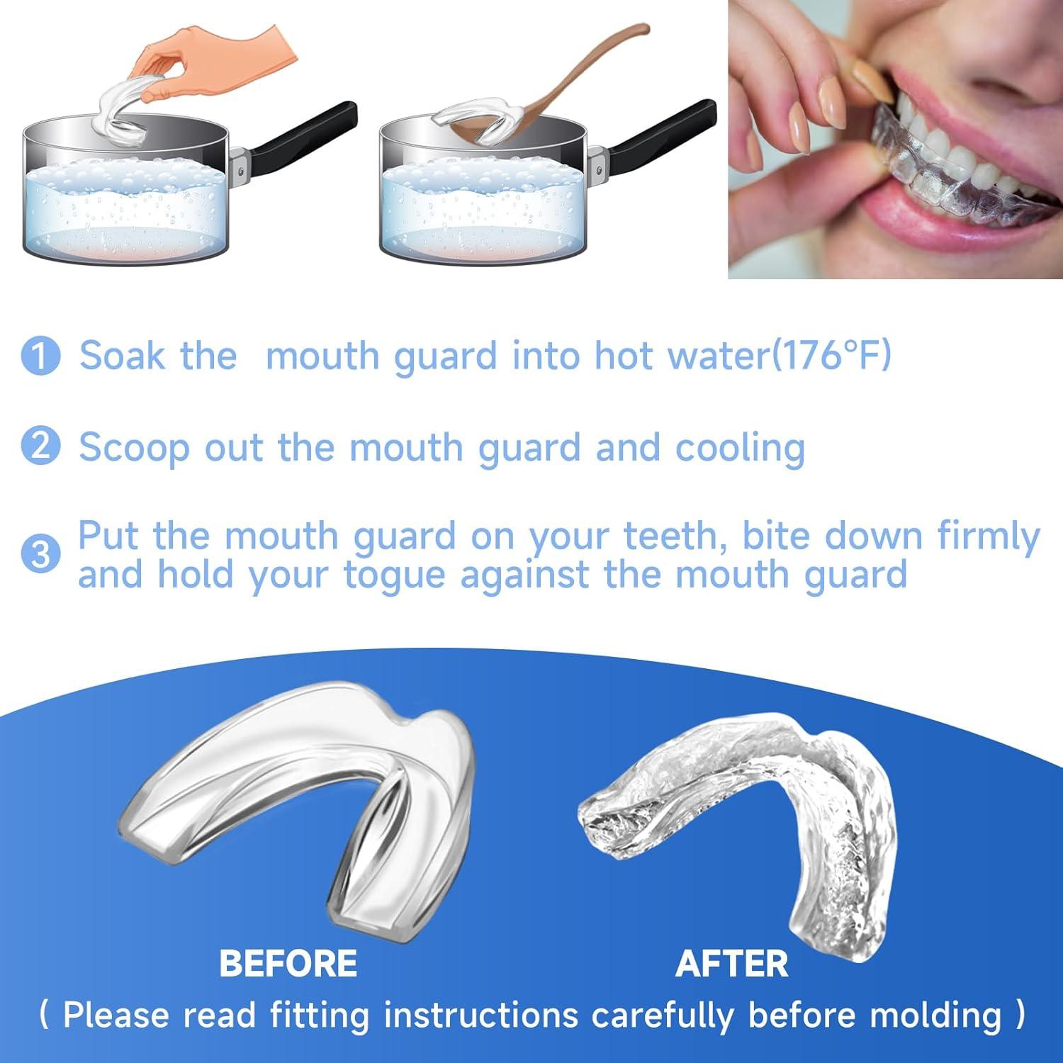 Protector Bucal Moldable Azul Mictaning para Niños - Paquete de 4