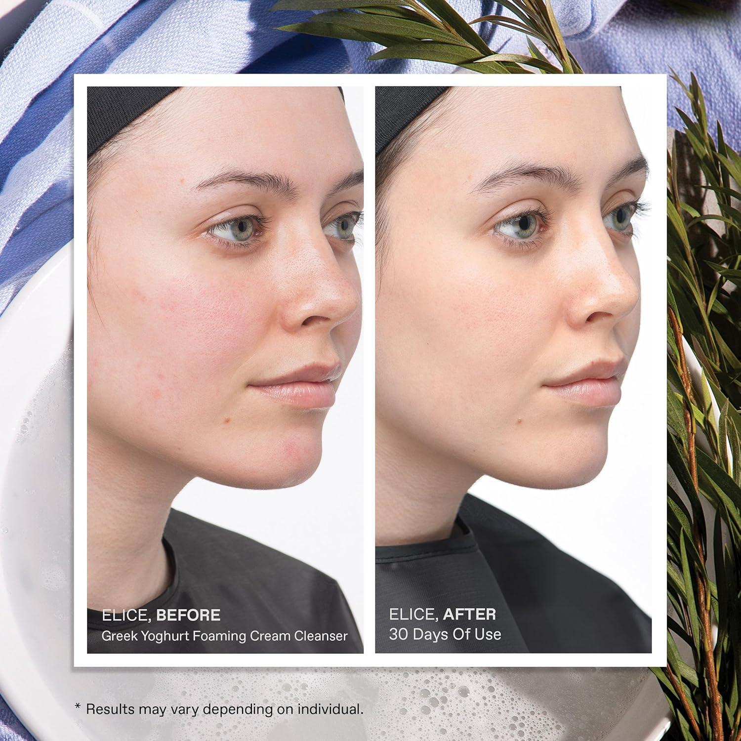 Limpiador Facial Espumoso KORRES 150 ml - Yogur Griego