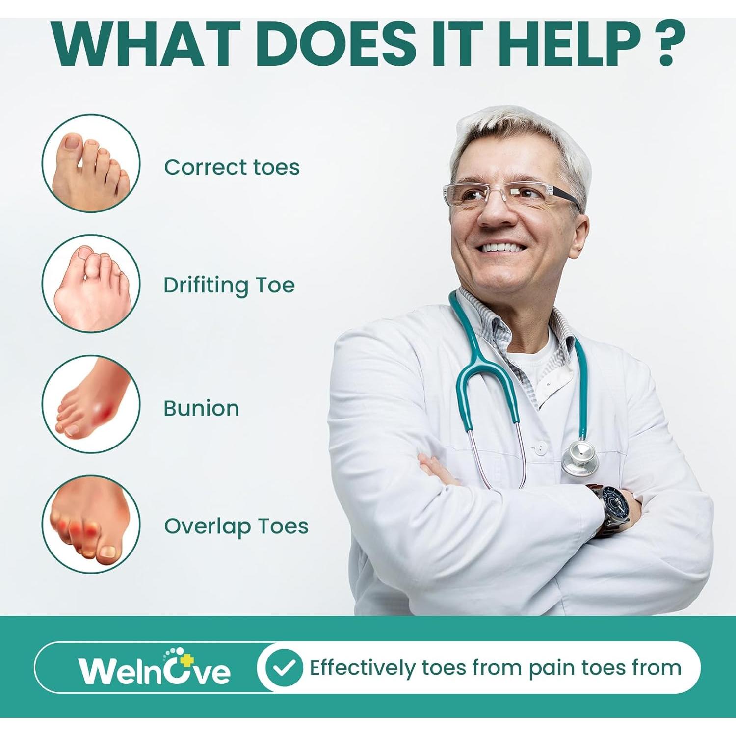 Almohadillas Correctoras para Juanetes Welnove - 8 Piezas Gel