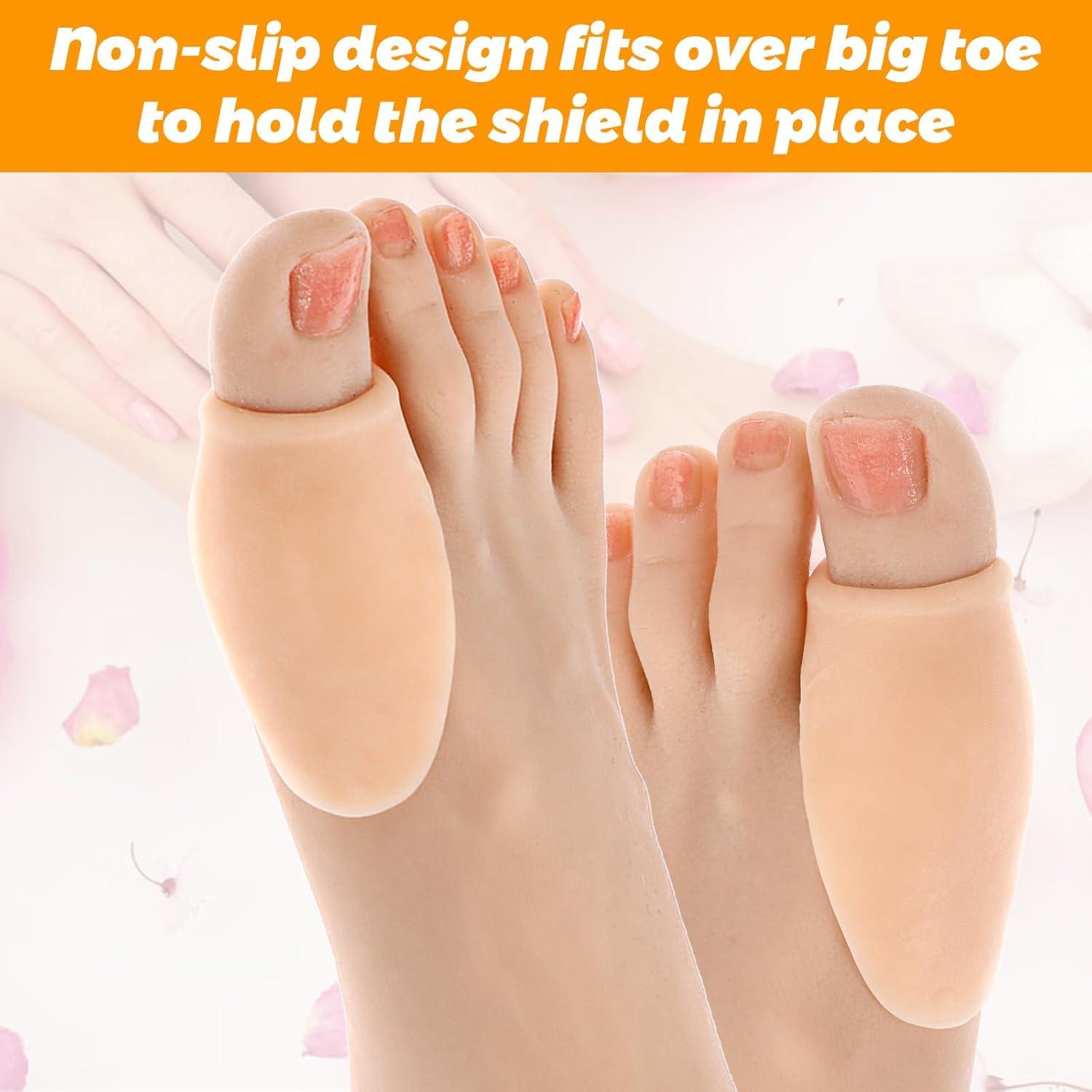 12 Protectores de Juanetes Transparentes Alivio Callos Color Piel