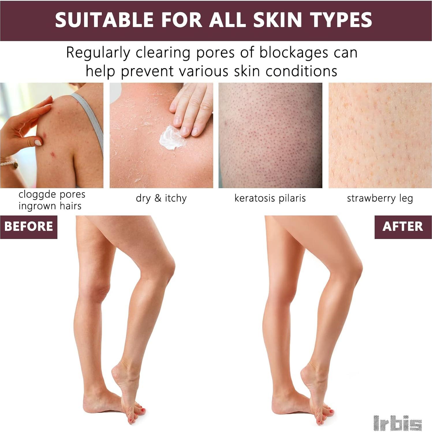 Guante Exfoliante Corporal Irbis - Mitón Doble Textura 27.4cm