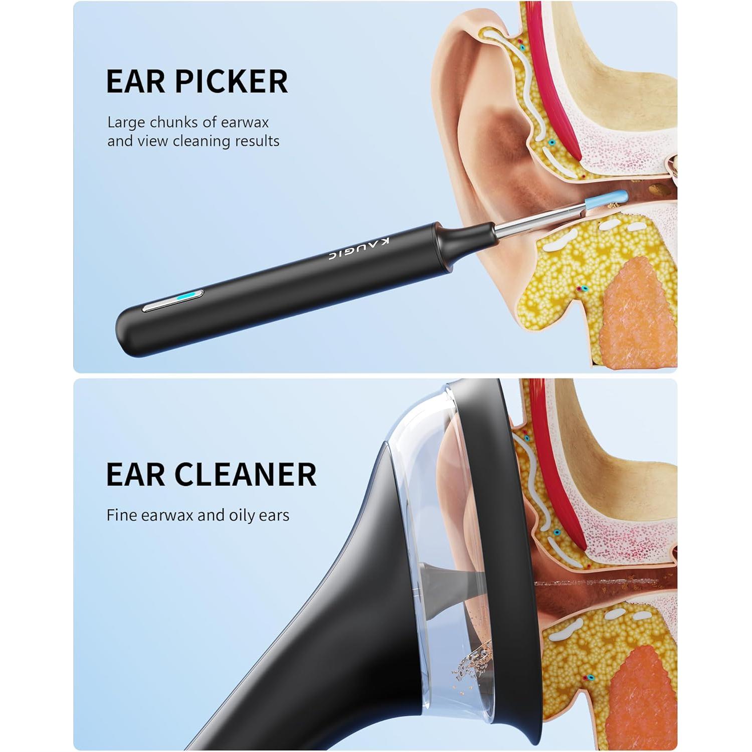 Kit de Limpieza de Oídos KAUGIC con Cámara 1080 HD y Irrigación