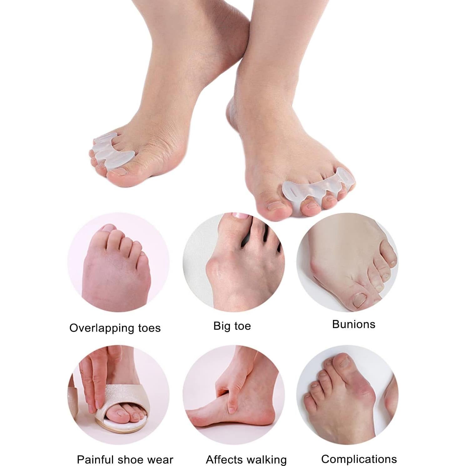 Separadores de Dedos de Silicona Golbylicc - 2 Pares para Juanetes