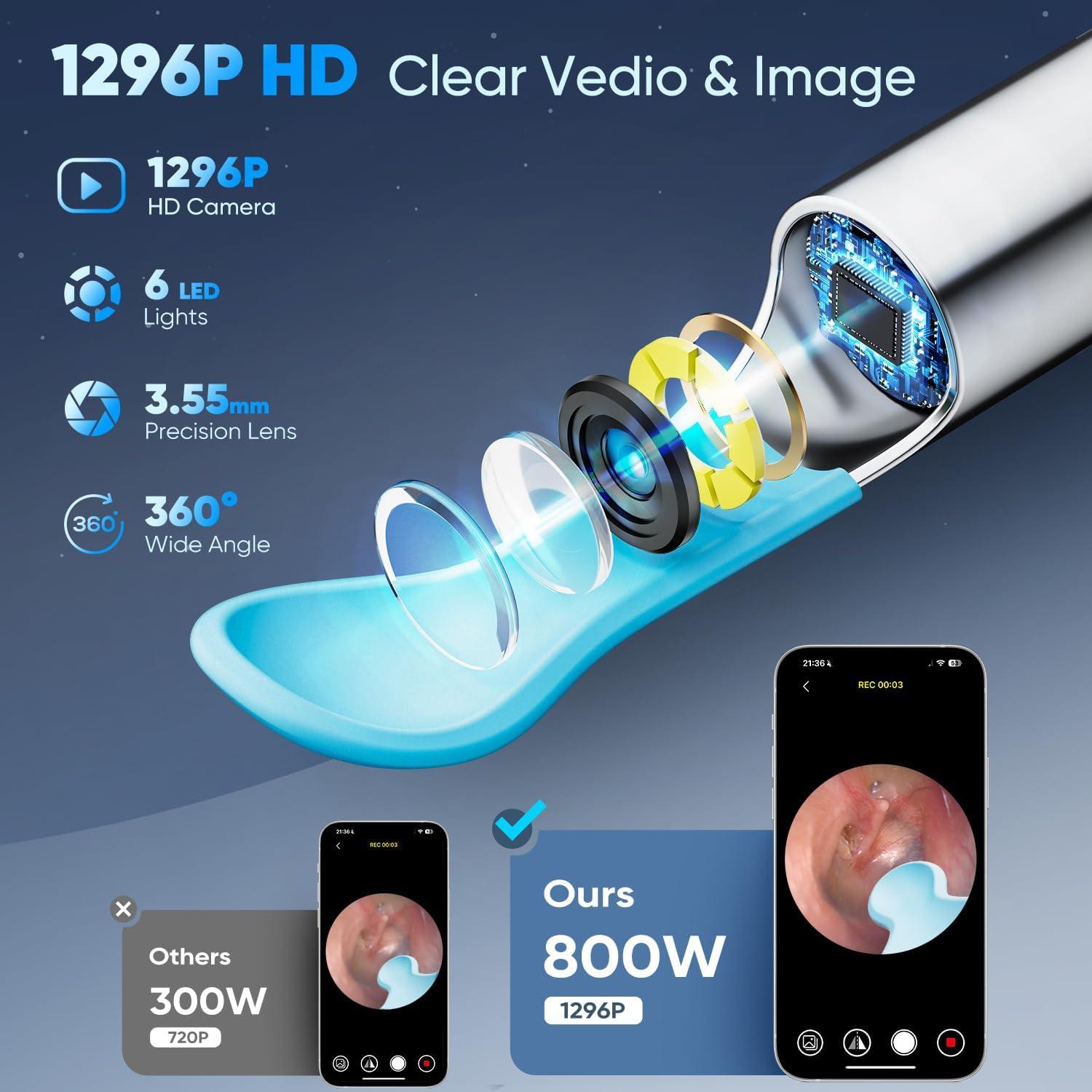 Kit Eliminación de Cerumen MOOPHY con Cámara 1296P y 6 Luces LED