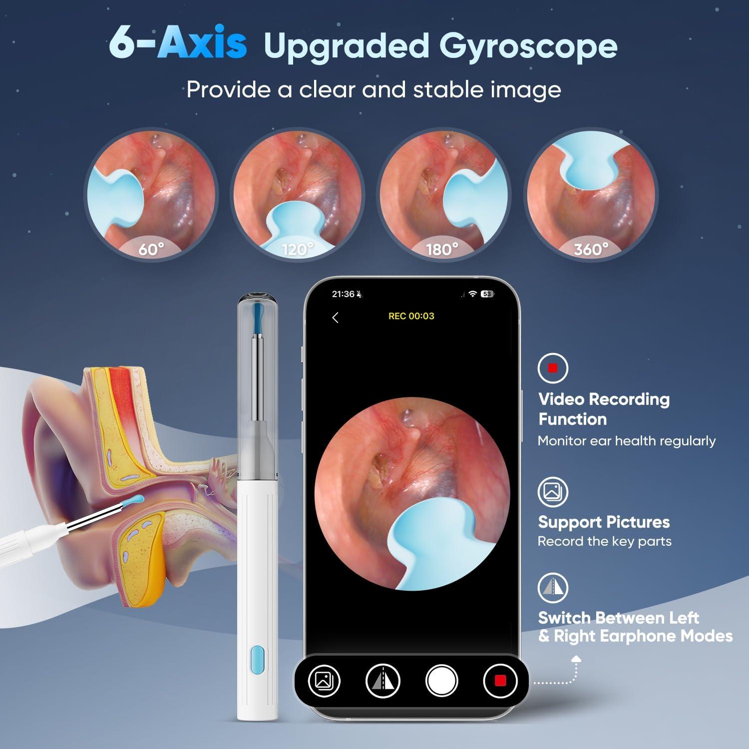 Kit Eliminación de Cerumen MOOPHY con Cámara 1296P y 6 Luces LED