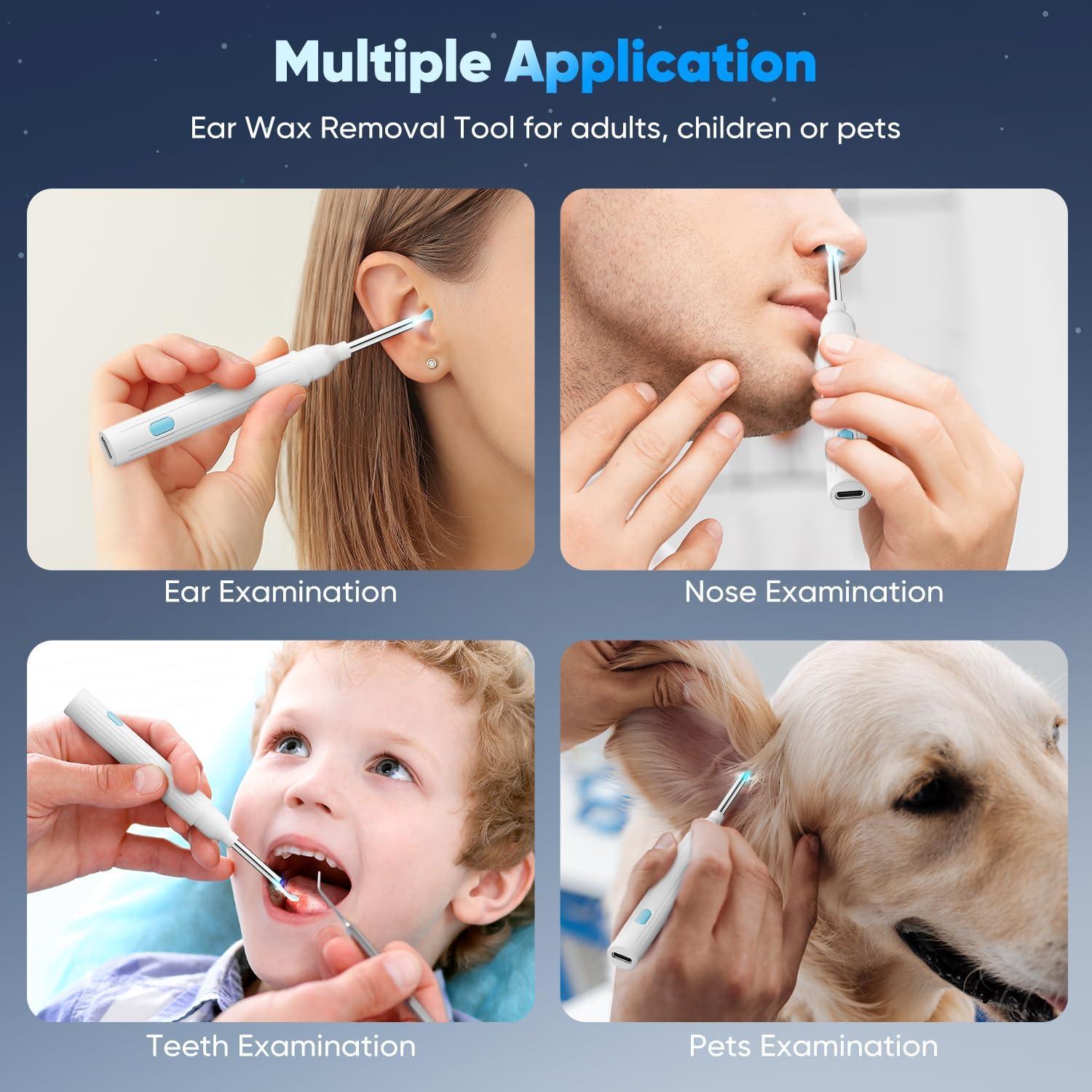 Kit Eliminación de Cerumen MOOPHY con Cámara 1296P y 6 Luces LED