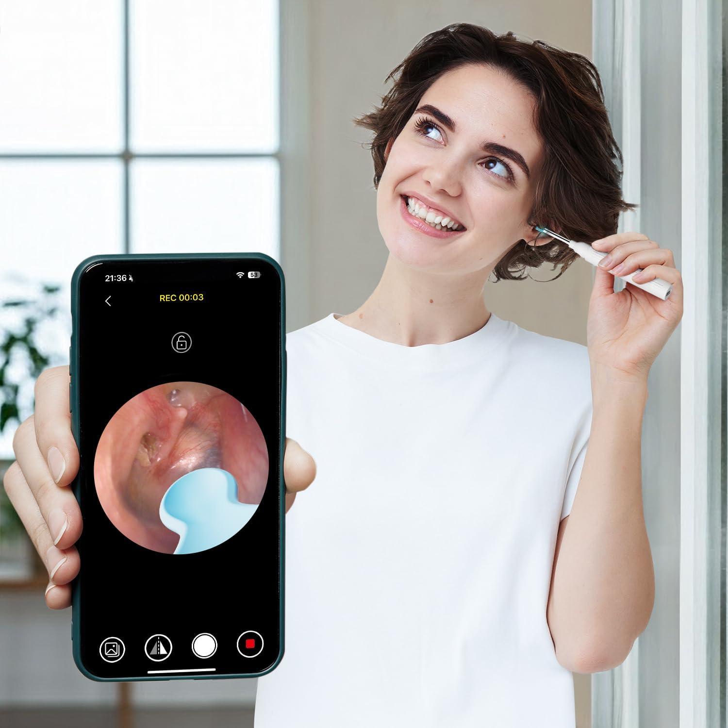 Kit Eliminación de Cerumen MOOPHY con Cámara 1296P y 6 Luces LED