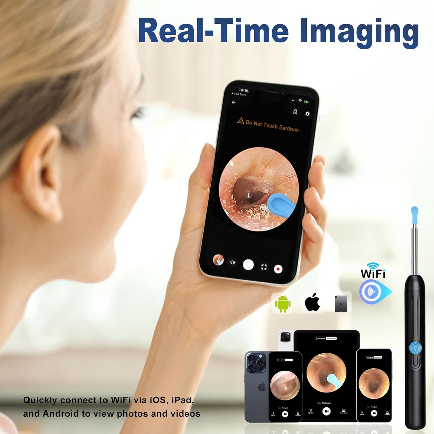 Limpiador de Oído NTGISO con Cámara 1080P y 6 LED