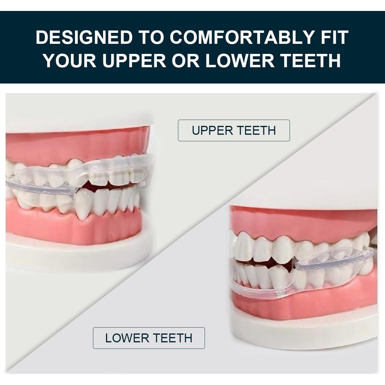 Protector Bucal Antirrechinado Wokyo - Paquete de 10 Unidades