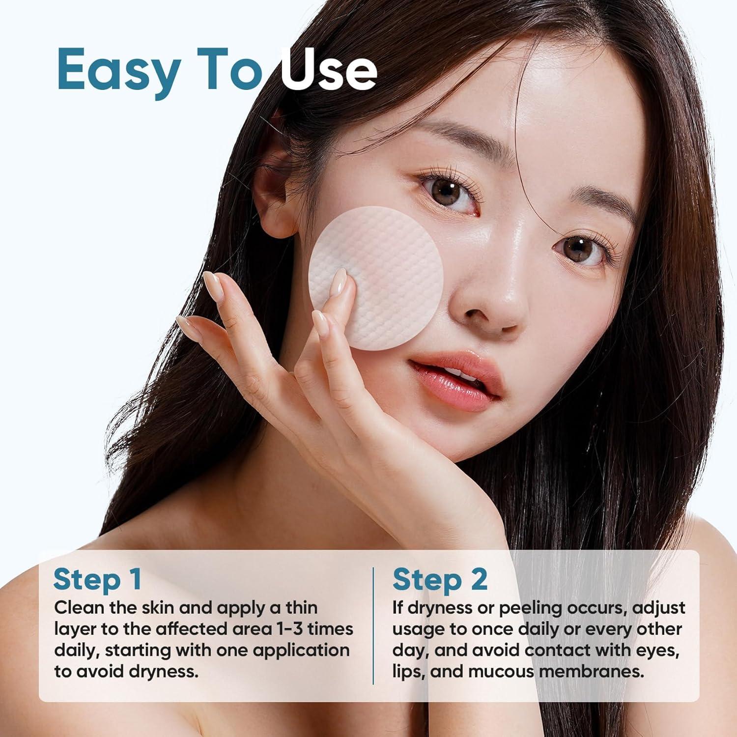 Elvira Glycolic Acid Exfoliating Facial Pads With 10% Glycolic Acid, 2% Salicylic Acid & Niacinamide - 60 Toner Pads, Daily Peel Treatment for Acne Prone Sensitive Skin