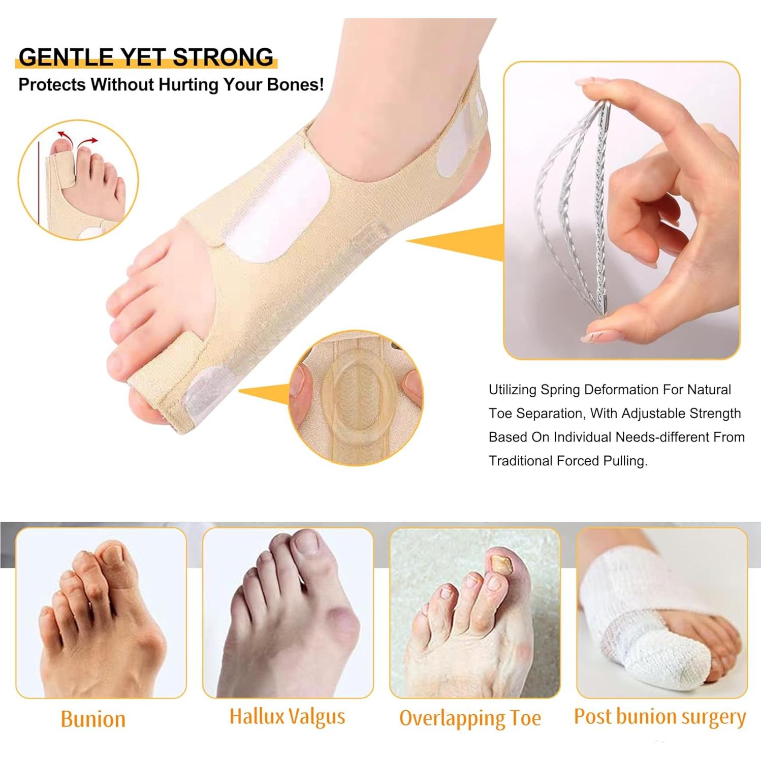 Corrector de Juanetes Siwujia para Hallux Valgus - 2 Piezas